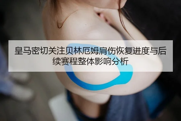 皇马密切关注贝林厄姆肩伤恢复进度与后续赛程整体影响分析
